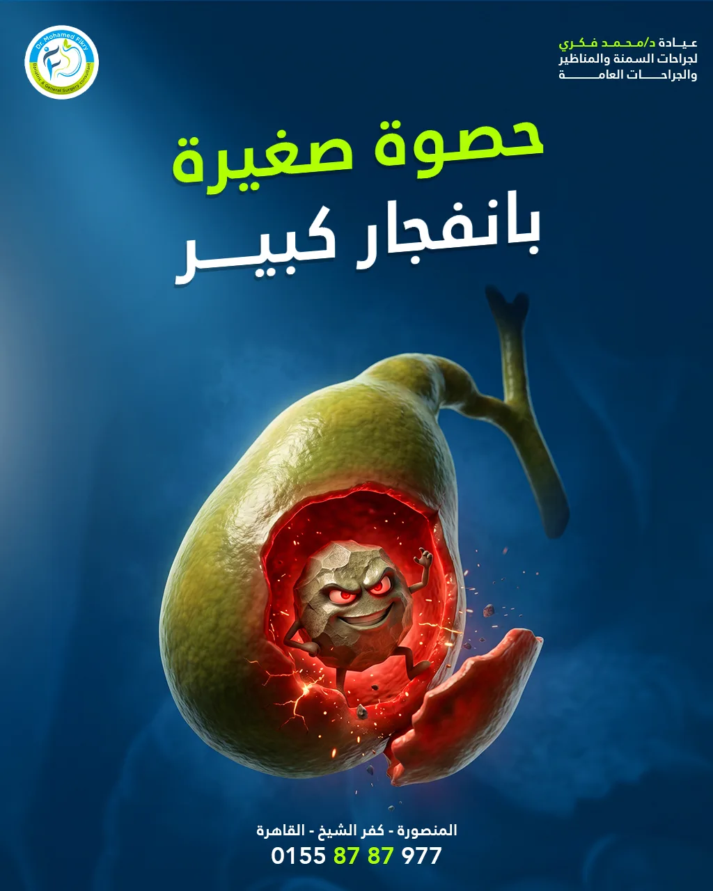 حصوة
