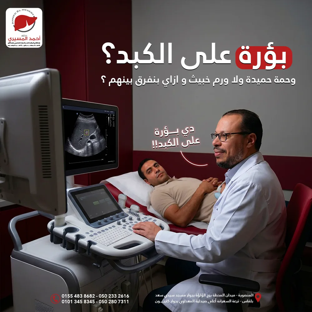 بؤرة
